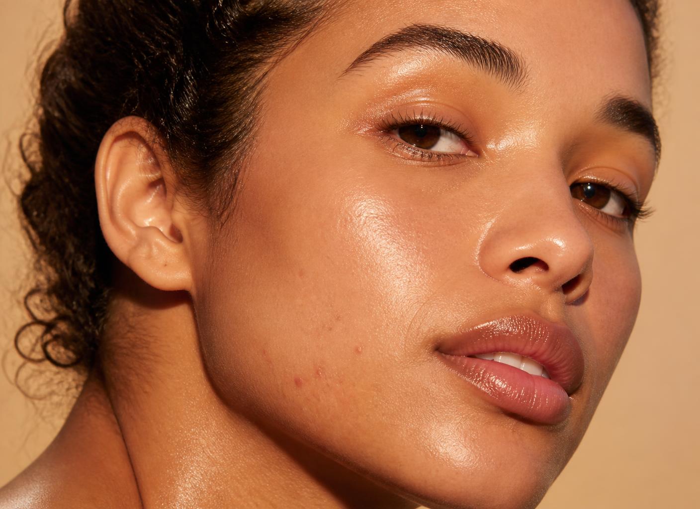 Rosto de mulher com pele iluminada e marcas leves de acne na mandíbula